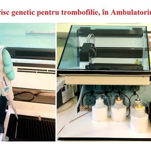 Test de risc genetic pentru trombofilie, în Ambulatoriul SUUB